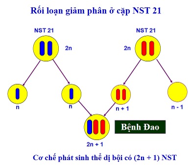 Rối loạn giảm phân ở cặp NST 21 dẫn đến hình thành hội chứng Down