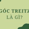 Góc Treitz là gì? Cấu tạo và chức năng trong cơ thể người